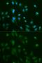 Arrestin Beta 1 antibody, GTX30065, GeneTex, Immunofluorescence image 