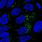 3-Hydroxy-3-Methylglutaryl-CoA Synthase 2 antibody, PA5-55620, Invitrogen Antibodies, Immunofluorescence image 