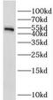 Serine/Threonine Kinase 25 antibody, FNab08328, FineTest, Western Blot image 
