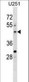 Pleckstrin Homology Domain Containing O2 antibody, LS-C163793, Lifespan Biosciences, Western Blot image 