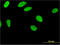 Zinc Finger Protein 35 antibody, LS-C198463, Lifespan Biosciences, Immunofluorescence image 