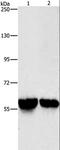 Aldehyde Dehydrogenase 8 Family Member A1 antibody, LS-C404485, Lifespan Biosciences, Western Blot image 
