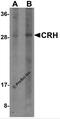 Corticotropin Releasing Hormone antibody, 7797, ProSci, Western Blot image 