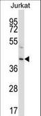 Protein C, Inactivator Of Coagulation Factors Va And VIIIa antibody, LS-C162166, Lifespan Biosciences, Western Blot image 