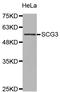 Secretogranin III antibody, STJ27776, St John