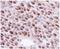 RAD51 Recombinase antibody, GTX70230, GeneTex, Immunohistochemistry paraffin image 