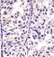 Cyclin Dependent Kinase 4 antibody, M00159-2, Boster Biological Technology, Immunohistochemistry paraffin image 