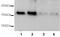Rho Associated Coiled-Coil Containing Protein Kinase 2 antibody, ab71598, Abcam, Western Blot image 