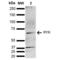 Receptor Like Tyrosine Kinase antibody, LS-C775038, Lifespan Biosciences, Western Blot image 