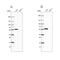 Propionyl-CoA Carboxylase Subunit Beta antibody, PA5-57879, Invitrogen Antibodies, Western Blot image 