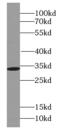 ADP/ATP translocase 3 antibody, FNab07947, FineTest, Western Blot image 