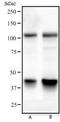 Nuclear Factor Kappa B Subunit 1 antibody, NBP2-22202, Novus Biologicals, Western Blot image 