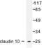 Claudin 10 antibody, LS-C175964, Lifespan Biosciences, Western Blot image 