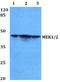 Mitogen-Activated Protein Kinase Kinase 1 antibody, A00292S211, Boster Biological Technology, Western Blot image 
