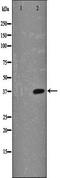 NFKB Inhibitor Alpha antibody, orb99247, Biorbyt, Western Blot image 