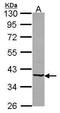 Beta-1,4-Galactosyltransferase 4 antibody, GTX115980, GeneTex, Western Blot image 