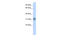 Ribose 5-Phosphate Isomerase A antibody, 27-024, ProSci, Western Blot image 