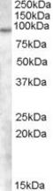 Trichohyalin Like 1 antibody, PA5-18970, Invitrogen Antibodies, Western Blot image 