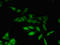 Phosphorylated adapter RNA export protein antibody, LS-C679007, Lifespan Biosciences, Immunofluorescence image 