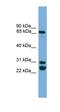 Dynein Axonemal Intermediate Chain 2 antibody, orb330248, Biorbyt, Western Blot image 