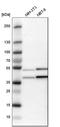 Coiled-Coil Domain Containing 51 antibody, HPA010980, Atlas Antibodies, Western Blot image 