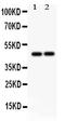 MPTP antibody, PB9501, Boster Biological Technology, Western Blot image 