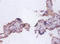 FAS antibody, A53081-100, Epigentek, Immunohistochemistry paraffin image 