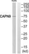 Calpain 9 antibody, abx014292, Abbexa, Western Blot image 