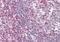 Zeta Chain Of T Cell Receptor Associated Protein Kinase 70 antibody, orb88793, Biorbyt, Immunohistochemistry paraffin image 