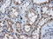 AKT Serine/Threonine Kinase 2 antibody, LS-C114889, Lifespan Biosciences, Immunohistochemistry paraffin image 