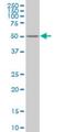 Zinc Finger Protein 213 antibody, H00007760-M02, Novus Biologicals, Western Blot image 