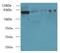 ClpB Homolog, Mitochondrial AAA ATPase Chaperonin antibody, LS-C379958, Lifespan Biosciences, Western Blot image 