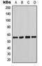 Checkpoint Kinase 1 antibody, MBS820527, MyBioSource, Western Blot image 