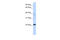 Chromosome 11 Open Reading Frame 74 antibody, 26-667, ProSci, Enzyme Linked Immunosorbent Assay image 