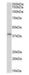 G Protein Subunit Alpha I2 antibody, orb308869, Biorbyt, Western Blot image 