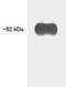 Thyroid Hormone Receptor Beta antibody, GTX22744, GeneTex, Western Blot image 