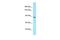 Inter-alpha-trypsin inhibitor heavy chain H5 antibody, PA5-45830, Invitrogen Antibodies, Western Blot image 