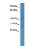 GTP Cyclohydrolase 1 antibody, NBP1-79771, Novus Biologicals, Western Blot image 