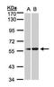 Plasma protease C1 inhibitor antibody, TA308542, Origene, Western Blot image 