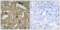 BTB Domain Containing 6 antibody, abx013762, Abbexa, Western Blot image 