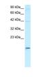 Asialoglycoprotein Receptor 2 antibody, orb329730, Biorbyt, Western Blot image 