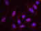 SWI/SNF Related, Matrix Associated, Actin Dependent Regulator Of Chromatin, Subfamily A, Member 4 antibody, NB100-2594, Novus Biologicals, Proximity Ligation Assay image 