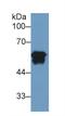 Fibrinogen Beta Chain antibody, LS-C292425, Lifespan Biosciences, Western Blot image 