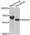 Anti-Mullerian Hormone Receptor Type 2 antibody, A03970, Boster Biological Technology, Western Blot image 