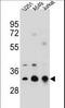 Tropomyosin 4 antibody, LS-B13767, Lifespan Biosciences, Western Blot image 