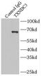 NME/NM23 Family Member 8 antibody, FNab09125, FineTest, Immunoprecipitation image 