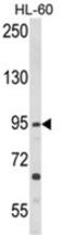 Toll Like Receptor 3 antibody, AP18223PU-N, Origene, Western Blot image 