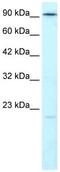 DNA Ligase 4 antibody, ab26039, Abcam, Western Blot image 