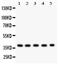 Snail2 antibody, PB9439, Boster Biological Technology, Western Blot image 