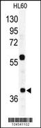 RAD23 Homolog A, Nucleotide Excision Repair Protein antibody, 61-127, ProSci, Western Blot image 